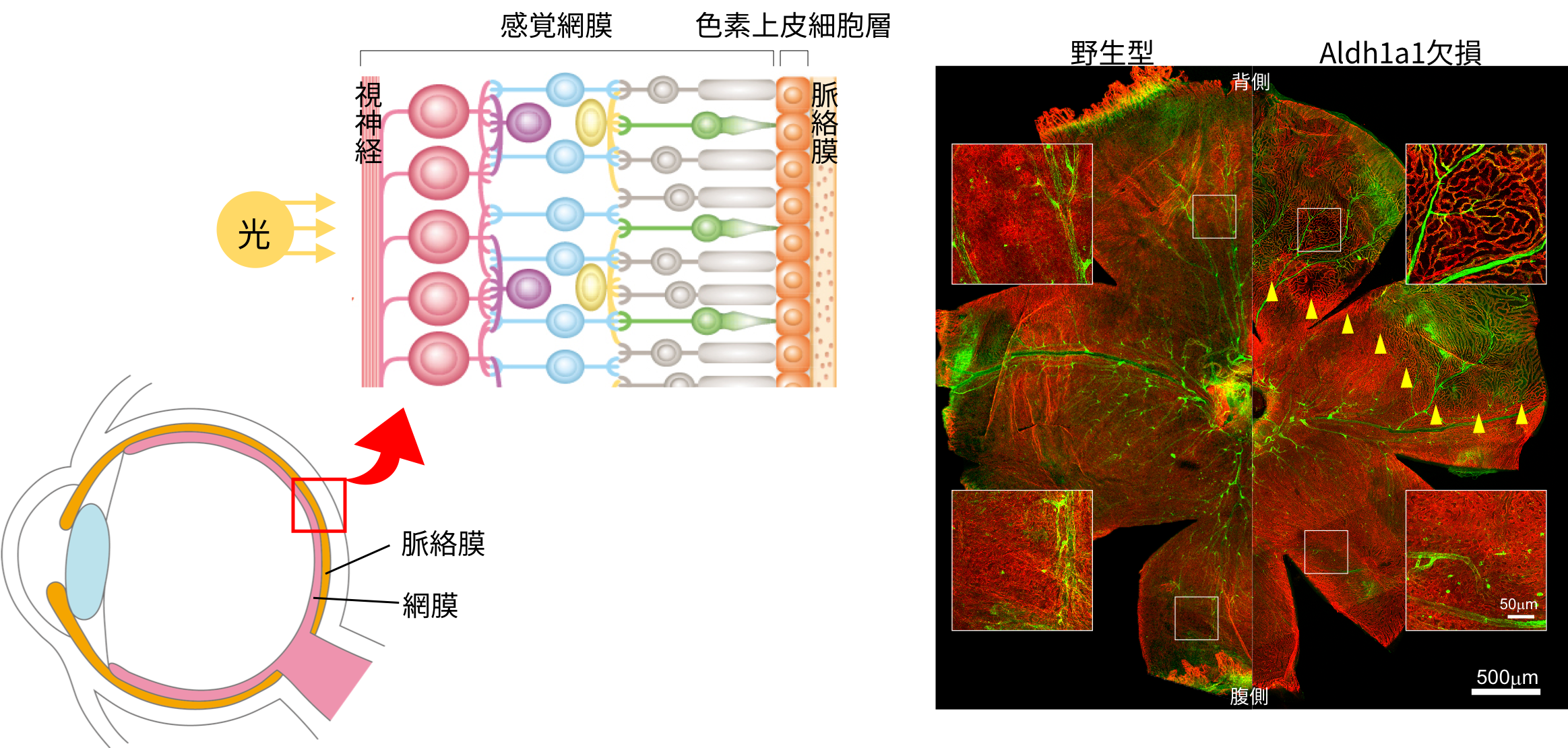 左：眼の基本的な構造。右：眼球における血管形成の免疫染⾊。イソレクチンB4（緑）は血管を、エンドムチン（赤）は微小血管を⽰している。Aldh1a1欠損マウスの背側（右上）で、血管形成不全が観察される。